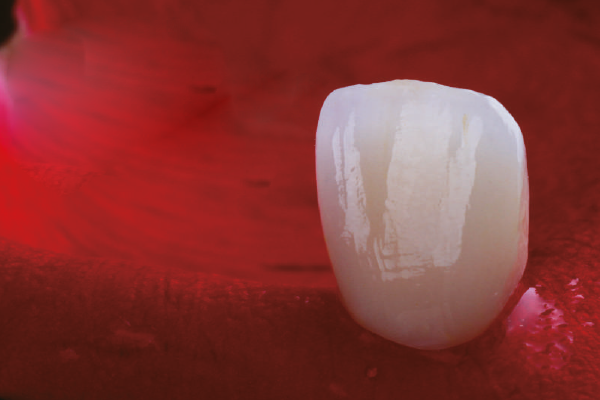 Zirconia